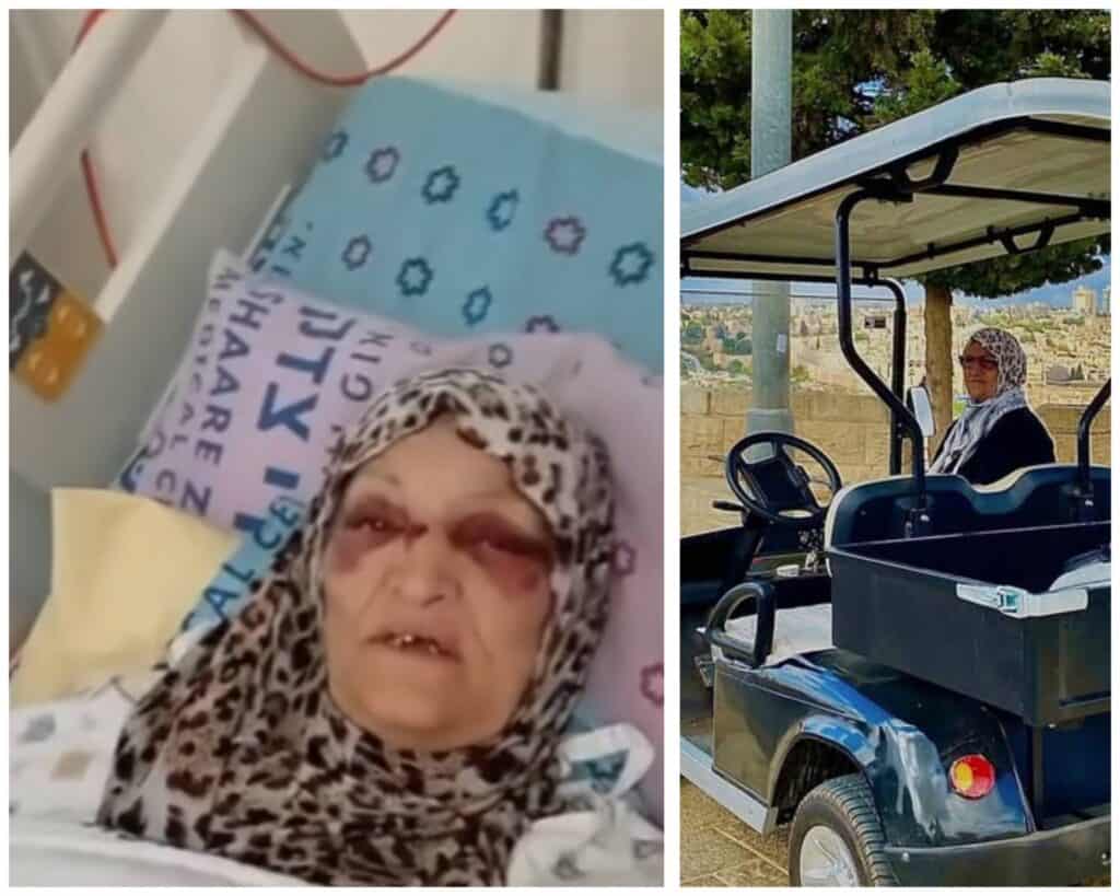 Nafisa Khweis hospitalized after electric cart accident in East Jerusalem am