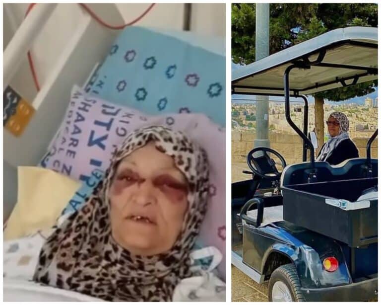 Nafisa Khweis hospitalized after electric cart accident in East Jerusalem am