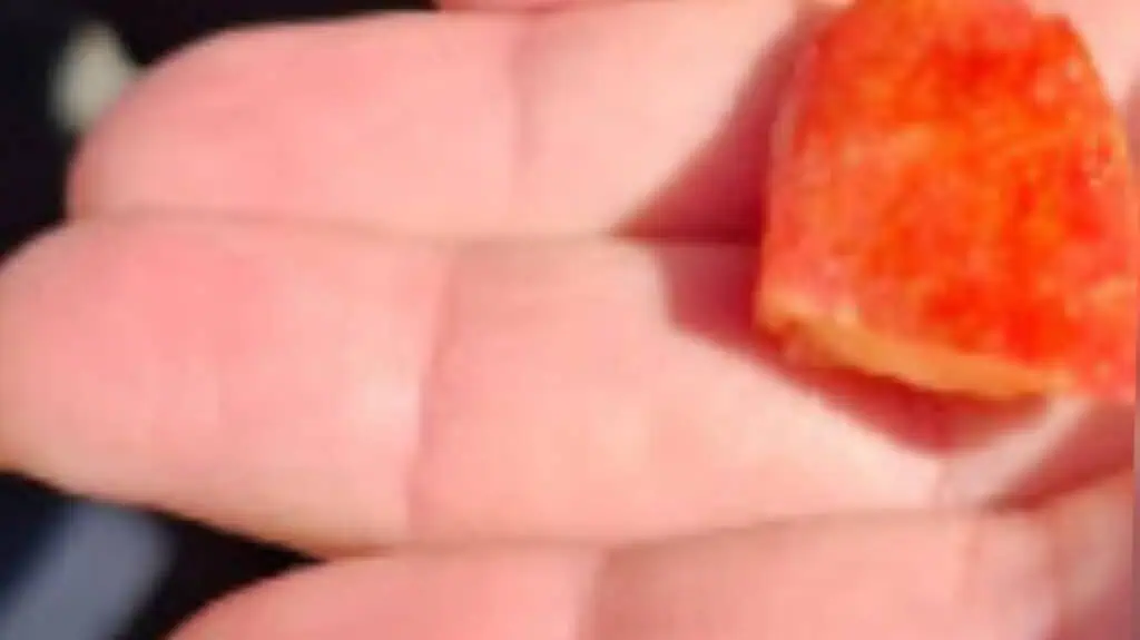 बैतुलमक़दिस में यूनाइटेड हत्ज़ालाह के चिकित्सा कर्मी जिन्होंने छह वर्षीय बच्चे को घर पर सेब के टुकड़े से दम घुटने से बचाया